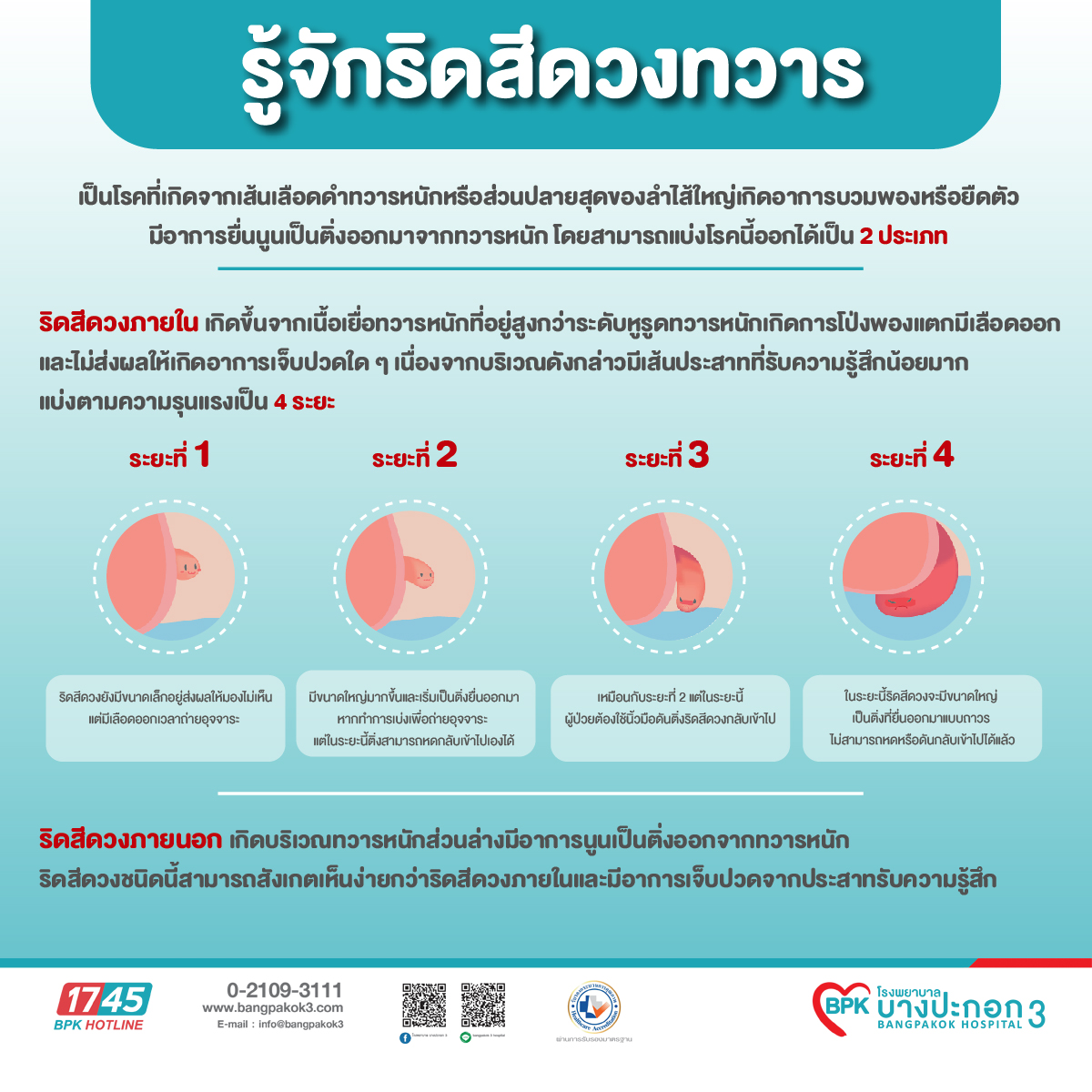 อันดับหนึ่ง 104+ ภาพ ริดสีดวง อาการ รูปภาพ อัปเดต